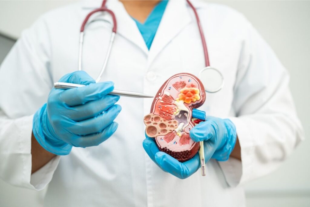 Kidney Cancer Treatment in Istanbul