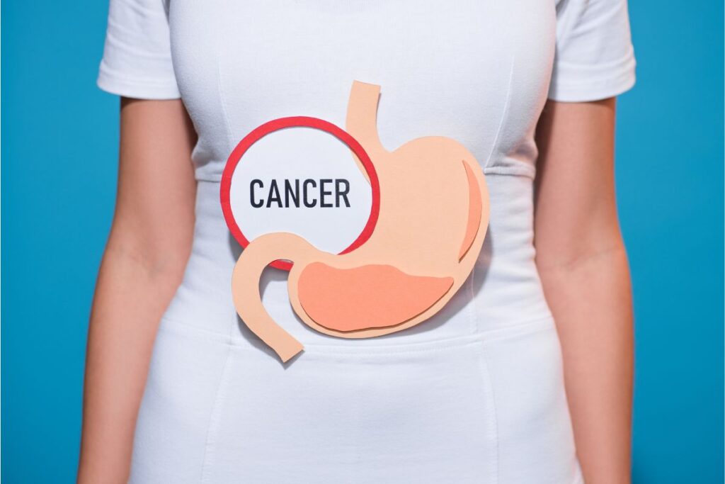 Stomach cancer treatment in Istanbul